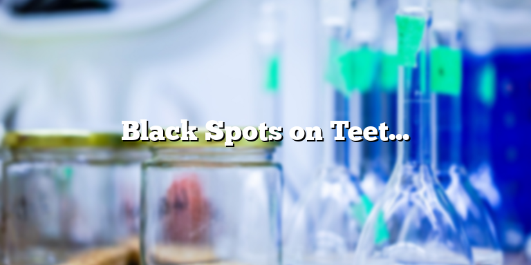 Black Spots on Teeth: Effective Ways to Remove Them